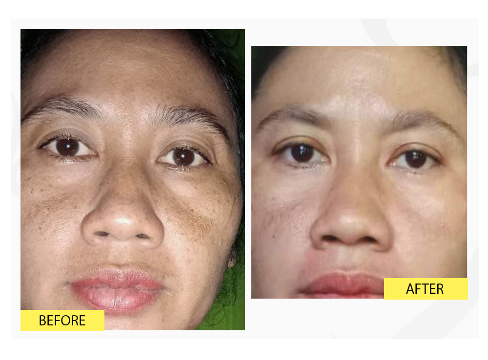 EXCLUSIVE OILY DAY & NIGHT CREAM