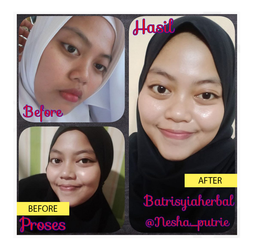 EXCLUSIVE OILY DAY & NIGHT CREAM