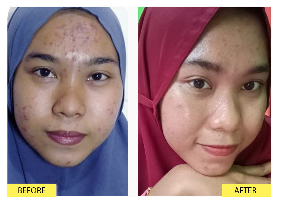 EXCLUSIVE OILY DAY CREAM